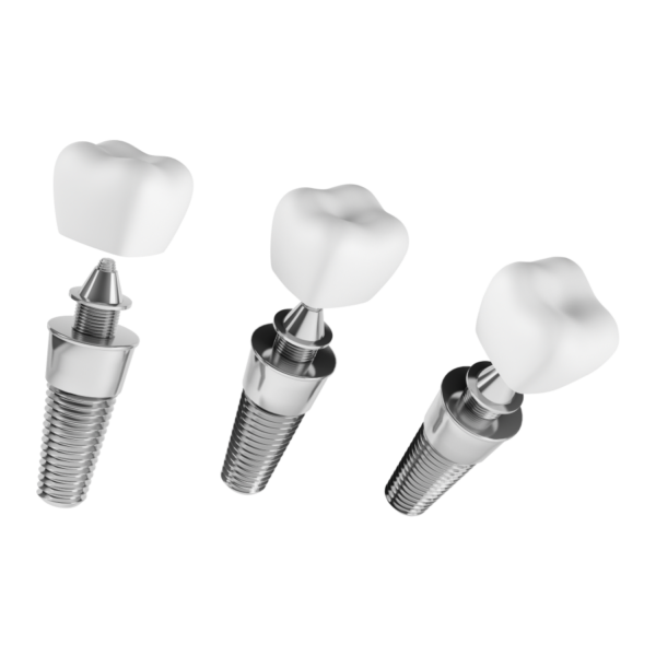 Zubný Implantát - Image 2